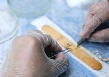 Iskrena iskustva i usporedba FUE, FUT i DHI metoda presađivanja kose