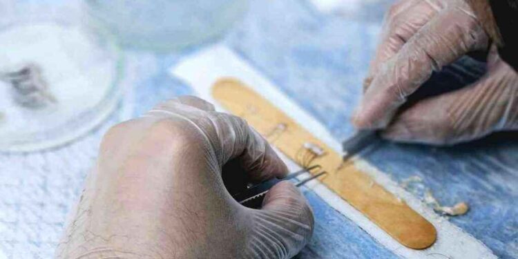 Iskrena iskustva i usporedba FUE, FUT i DHI metoda presađivanja kose 1 Iskrena iskustva i usporedba FUE, FUT i DHI metoda presađivanja kose