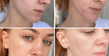 RECENZIJE DYSON V15: REVOLUCIJA U ČISTOĆI DOMA