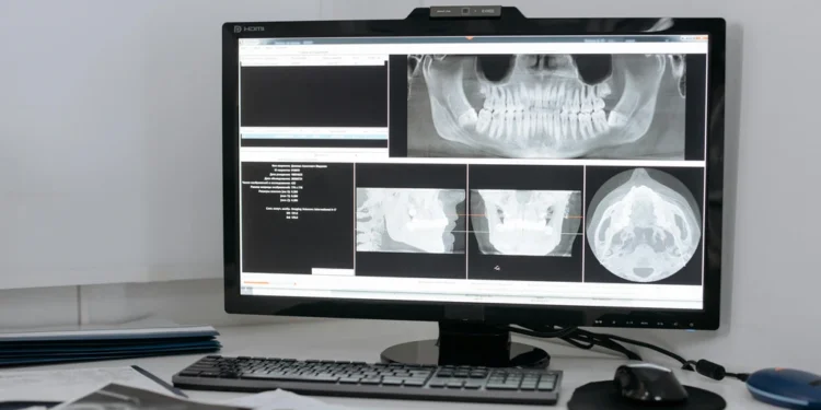Top 3 originalna i korisna pomagala za ruke: odabir za umirene ruke i umirene misli 1 static photos 1774693671