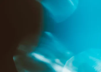 static photos 1775074057